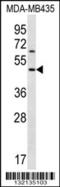 Keratocan antibody, 56-540, ProSci, Western Blot image 