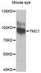 Transmembrane Channel Like 1 antibody, STJ111327, St John
