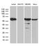 Protein Phosphatase 2 Scaffold Subunit Abeta antibody, LS-C795945, Lifespan Biosciences, Western Blot image 