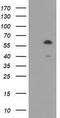 T-Complex 11 Like 2 antibody, LS-C172400, Lifespan Biosciences, Western Blot image 