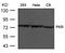 Eukaryotic Translation Initiation Factor 2 Alpha Kinase 2 antibody, MBS9404792, MyBioSource, Western Blot image 