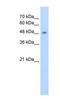 Cytochrome P450 Family 2 Subfamily A Member 13 antibody, NBP1-62400, Novus Biologicals, Western Blot image 