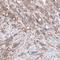 B-Raf Proto-Oncogene, Serine/Threonine Kinase antibody, NBP2-59034, Novus Biologicals, Immunohistochemistry frozen image 