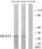 Olfactory Receptor Family 10 Subfamily T Member 2 antibody, PA5-38199, Invitrogen Antibodies, Western Blot image 