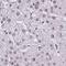 Proteasome Activator Subunit 4 antibody, NBP2-32575, Novus Biologicals, Immunohistochemistry frozen image 