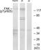 Protein Tyrosine Kinase 2 antibody, LS-C117356, Lifespan Biosciences, Western Blot image 