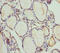 Pleckstrin Homology Domain Containing A1 antibody, LS-C676275, Lifespan Biosciences, Immunohistochemistry paraffin image 