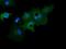 Growth Arrest Specific 7 antibody, GTX84462, GeneTex, Immunocytochemistry image 