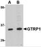 Growth Hormone Regulated TBC Protein 1 antibody, 4589, ProSci Inc, Western Blot image 