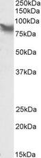 LIM Domain Containing Preferred Translocation Partner In Lipoma antibody, NBP1-46145, Novus Biologicals, Western Blot image 