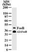 FosB Proto-Oncogene, AP-1 Transcription Factor Subunit antibody, GTX11959, GeneTex, Western Blot image 