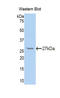 Nuclear Factor Kappa B Subunit 2 antibody, LS-C300857, Lifespan Biosciences, Western Blot image 