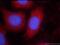 STAT3 antibody, 10253-2-AP, Proteintech Group, Immunofluorescence image 