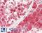 Casein Kinase 2 Alpha 1 antibody, LS-B11950, Lifespan Biosciences, Immunohistochemistry paraffin image 
