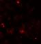 Rho Associated Coiled-Coil Containing Protein Kinase 1 antibody, NBP1-76569, Novus Biologicals, Immunofluorescence image 