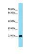 Probable gluconokinase antibody, orb326715, Biorbyt, Western Blot image 