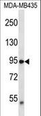 Transient receptor potential cation channel subfamily V member 2 antibody, LS-C160238, Lifespan Biosciences, Western Blot image 