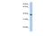 Aquaporin 10 antibody, PA5-43530, Invitrogen Antibodies, Western Blot image 