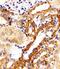 Kinesin Family Member 22 antibody, M05570, Boster Biological Technology, Immunohistochemistry paraffin image 