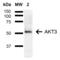 AKT Serine/Threonine Kinase 3 antibody, LS-C774427, Lifespan Biosciences, Western Blot image 