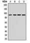 DEAD-Box Helicase 20 antibody, LS-C668565, Lifespan Biosciences, Western Blot image 