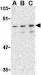 Protein Tyrosine Phosphatase Non-Receptor Type 11 antibody, GTX31744, GeneTex, Western Blot image 