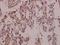 Protein Tyrosine Kinase 2 antibody, A00151Y397, Boster Biological Technology, Immunohistochemistry frozen image 