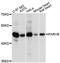Parvin Beta antibody, LS-C748220, Lifespan Biosciences, Western Blot image 
