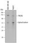 Phosphoinositide-3-Kinase Regulatory Subunit 5 antibody, MAB6388, R&D Systems, Western Blot image 