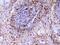 Vascular Cell Adhesion Molecule 1 antibody, A01199, Boster Biological Technology, Immunohistochemistry frozen image 