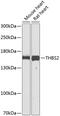 Thrombospondin 2 antibody, 23-659, ProSci, Western Blot image 