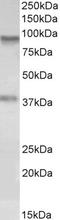 Amine Oxidase Copper Containing 3 antibody, EB09865, Everest Biotech, Western Blot image 