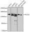 Phospholipase C Gamma 1 antibody, 16-190, ProSci, Western Blot image 