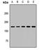 Rho GTPase Activating Protein 5 antibody, LS-C668233, Lifespan Biosciences, Western Blot image 