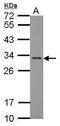 Fibroblast Growth Factor 13 antibody, PA5-27302, Invitrogen Antibodies, Western Blot image 