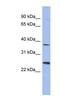 MAGE Family Member B2 antibody, NBP1-56839, Novus Biologicals, Western Blot image 