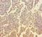 Zinc Finger Protein 662 antibody, A64000-100, Epigentek, Immunohistochemistry paraffin image 