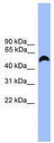 Macrophage Receptor With Collagenous Structure antibody, TA346120, Origene, Western Blot image 