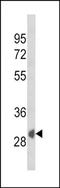 Calcium/Calmodulin Dependent Protein Kinase II Alpha antibody, orb235056, Biorbyt, Western Blot image 