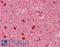 Doublecortin antibody, LS-B8946, Lifespan Biosciences, Immunohistochemistry frozen image 