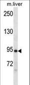 Doublecortin Like Kinase 1 antibody, LS-C164362, Lifespan Biosciences, Western Blot image 