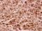 Protein Arginine Methyltransferase 5 antibody, NBP2-19935, Novus Biologicals, Immunohistochemistry paraffin image 