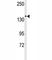 Transient Receptor Potential Cation Channel Subfamily M Member 7 antibody, F40170-0.4ML, NSJ Bioreagents, Western Blot image 