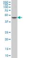 Gasdermin B antibody, H00055876-M06, Novus Biologicals, Western Blot image 