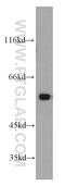 Pyruvate Kinase M1/2 antibody, 15821-1-AP, Proteintech Group, Western Blot image 