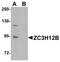 Zinc Finger CCCH-Type Containing 12B antibody, A16432, Boster Biological Technology, Western Blot image 