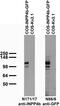 Inositol Polyphosphate-4-Phosphatase Type II B antibody, 75-218, Antibodies Incorporated, Western Blot image 