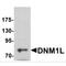 Dynamin 1 Like antibody, MBS153495, MyBioSource, Western Blot image 