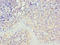 Serine/Threonine Kinase 16 antibody, LS-C376701, Lifespan Biosciences, Immunohistochemistry paraffin image 