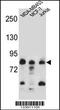 AFG3 Like Matrix AAA Peptidase Subunit 2 antibody, 56-926, ProSci, Western Blot image 